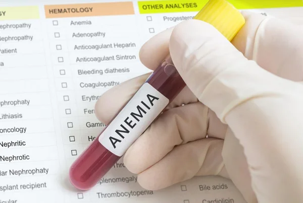 Anemia Complete Panel