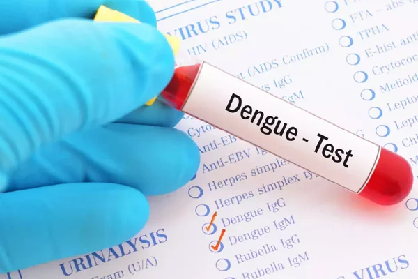 Dengue Fever Complete Panel