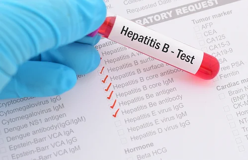 Hepatitis