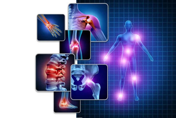 Joint Pain Complete Panel