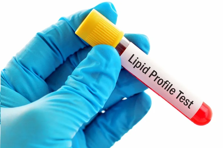 Lipid Complete Panel