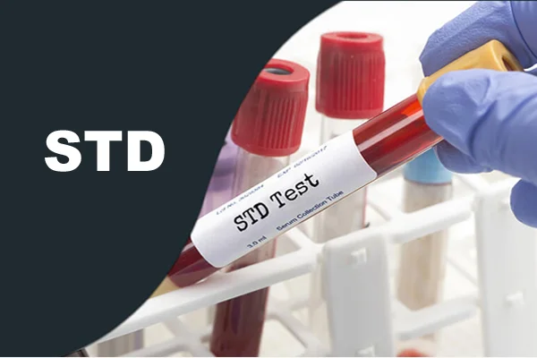 Sexual Transmitted Disease Panel
