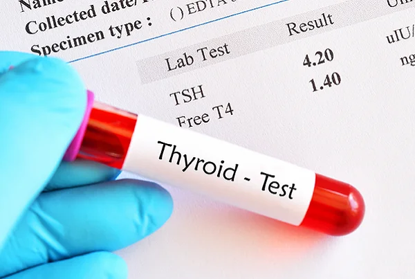 Thyroid Comprehensive Panel